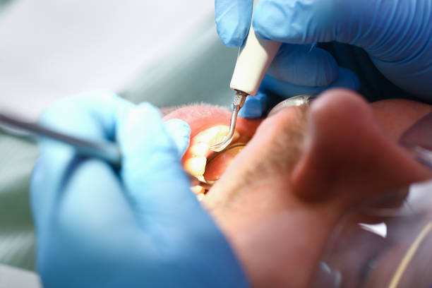 Best Mobile Emergency Dentist in Colquitt, GA