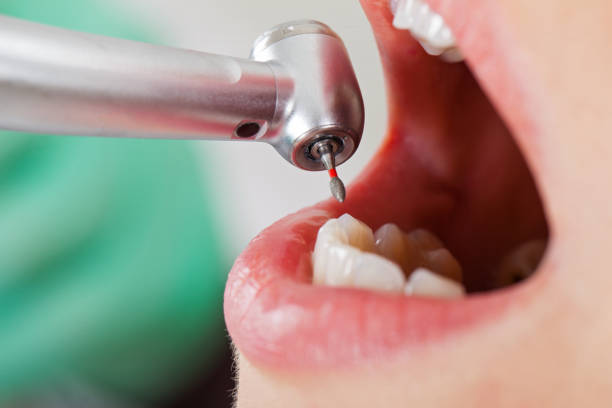 Best Broken or Cracked Tooth Emergency Dentist in Colquitt, GA